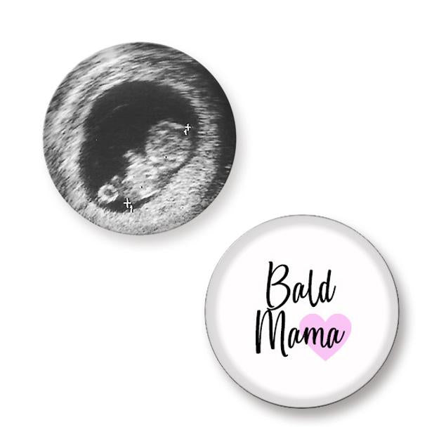 Button Set BALD MAMA (personalisierbar)