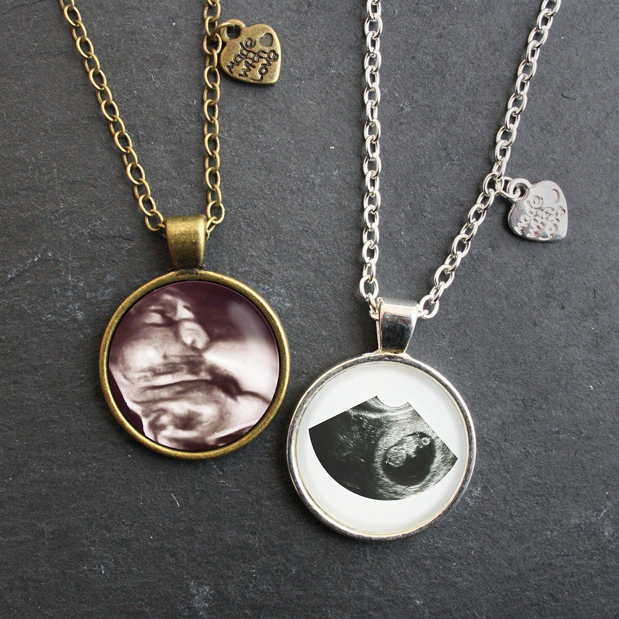 Personalisierte Kette - Ultraschallbild / Foto